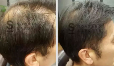 唯拾壹跨境美妝|我缺的不是卷發(fā)棒！不是錢(qián)！是頭發(fā)啊