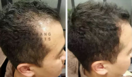 唯拾壹跨境美妝|我缺的不是卷發(fā)棒！不是錢(qián)！是頭發(fā)啊
