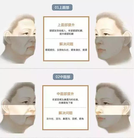 她只是做了個黃金V雕，3年后結果震驚了所有人！