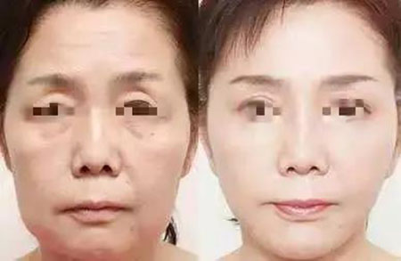 她只是做了個黃金V雕，3年后結果震驚了所有人！