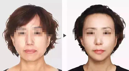 她只是做了個黃金V雕，3年后結果震驚了所有人！