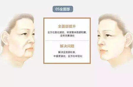 她只是做了個黃金V雕，3年后結果震驚了所有人！