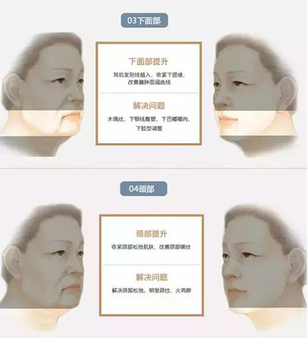 她只是做了個黃金V雕，3年后結果震驚了所有人！
