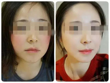 拒絕春季過敏、紅腫、發癢！敏感肌的救星來啦~