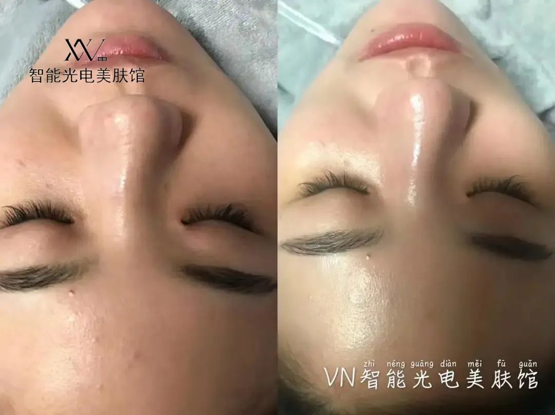VN美業(yè)運(yùn)營(yíng)：掌握這5種需求，顧客追著你買(mǎi)單！